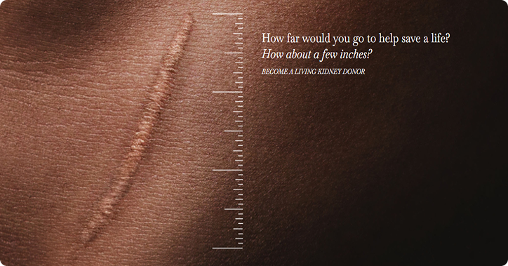 Close-up of a living kidney donor's surgical scar with a measuring ruler overlay, reading "How far would you go to help save a life? How about a few inches? Become a living kidney donor."