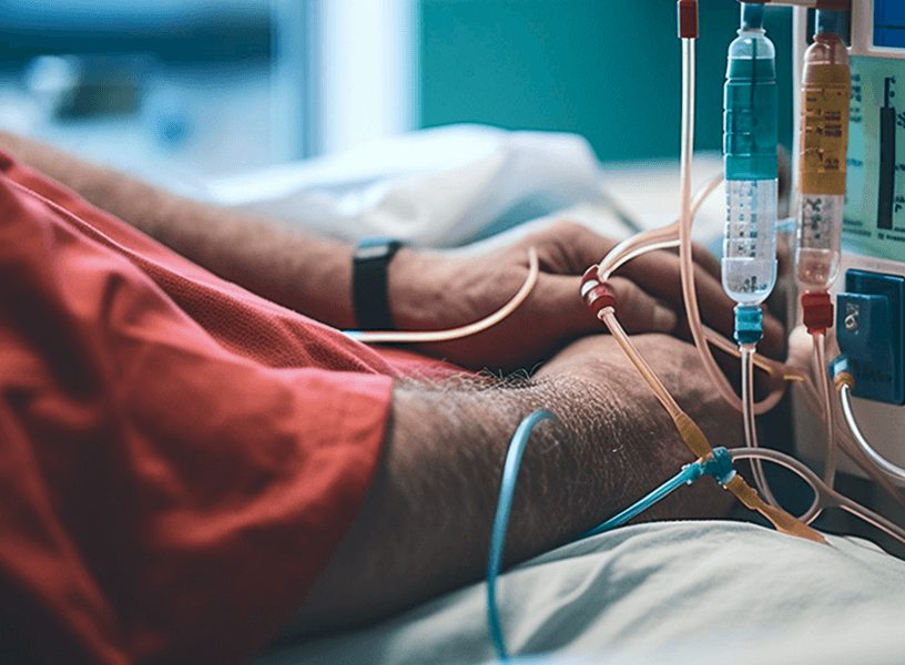 Close-up of a person’s arm connected to a dialysis machine with multiple tubes and fluid containers, wearing a red sleeve, in a clinical setting.
